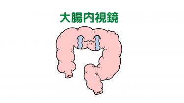 大腸内視鏡検査　今は思い出